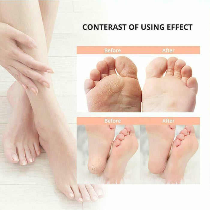Electric Care Pedicure Foot File Hard Dead Skin Callus Remover Foot Grinder New