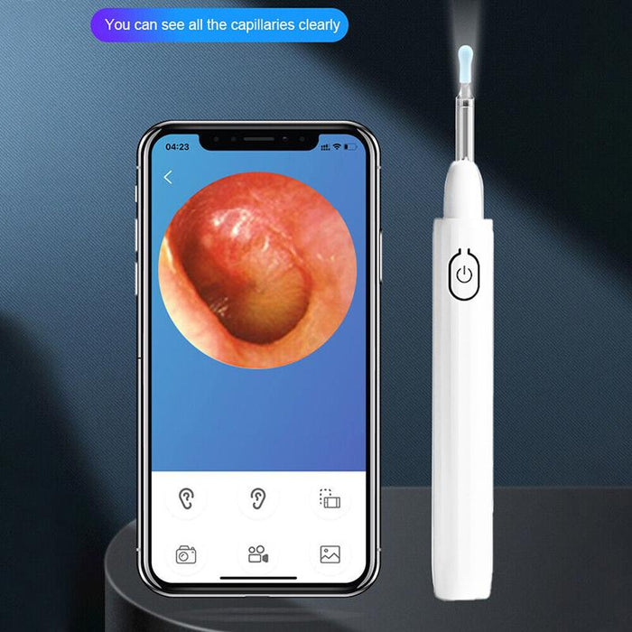 Ear Wax Remover Pick LED Light Scoop Tool Camera Cleaning Ear Cleaner Removal